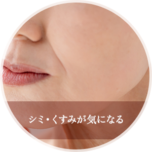 シミ・くすみが気になる