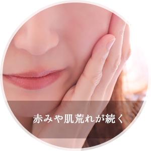 赤みや肌荒れが続く